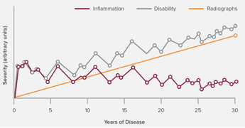 Disease progression in RA graph timeline